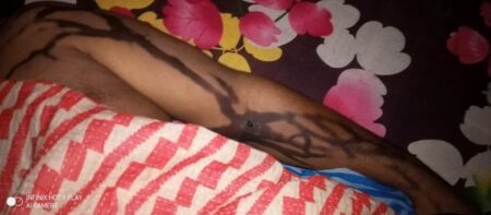যশোরে অ্যাসিড পুশ করে স্বামীকে হত্যা
