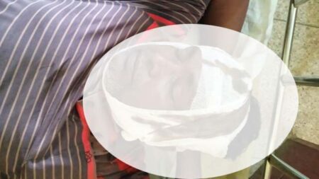 শ্যামনগর হাসপাতালে চিকিৎসাধীন মোহর উদ্দীন (৫০)