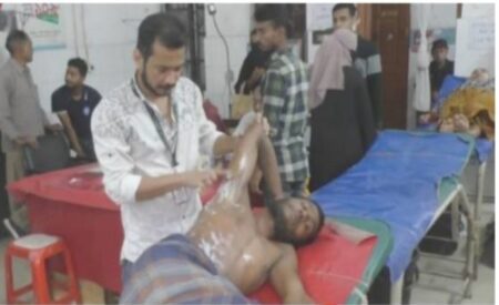 ব্যবসায়ীর গায়ে আগুন লাগিয়ে টাকা ছিনিয়ে নিল মাদকসেবী