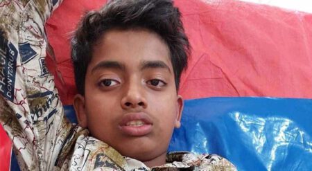 নিজের তৈরী আতশবাজিতে কিশোরের আঙ্গুল বিচ্ছিন্ন
