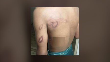 প্রেমিকার বাড়িতে যুবক, পিটিয়ে হাত-পা ভেঙে বাইরে ফেলে রাখা হয়