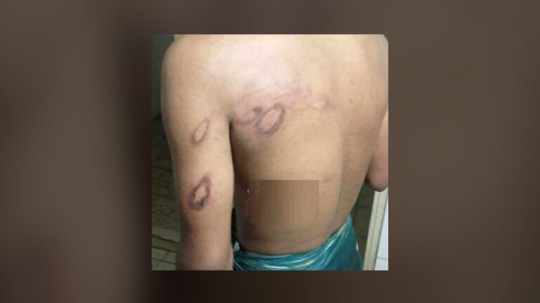 প্রেমিকার বাড়িতে যুবক, পিটিয়ে হাত-পা ভেঙে বাইরে ফেলে রাখা হয়