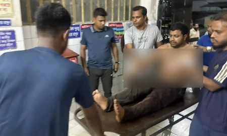 বেনাপোল কাস্টমস কর্মকর্তাকে কুপিয়ে জখম