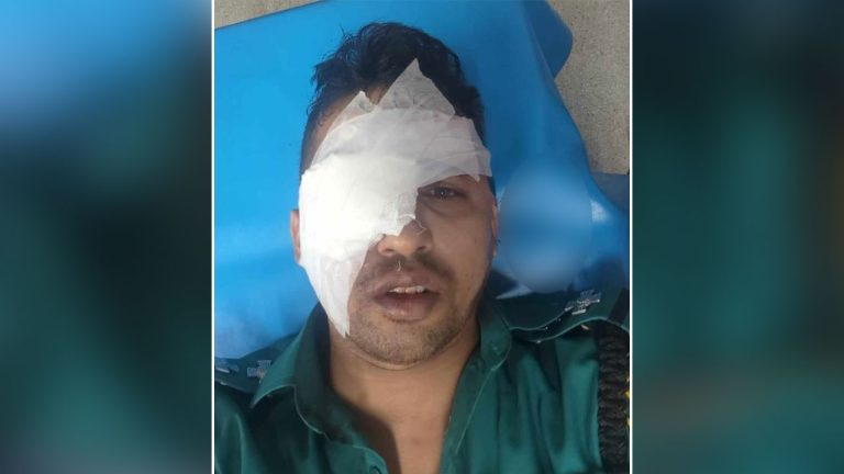 হিজড়াদের হামলায় চোখ হারাতে বসেছে পুলিশ