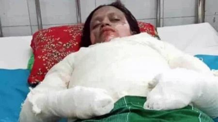 শরীরে ডিজেল ঢেলে গৃহবধূকে পুড়িয়ে হত্যার অভিযোগ