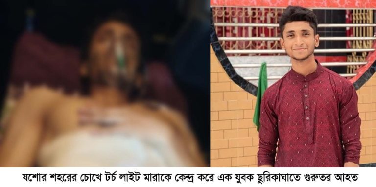 যশোরে টর্চ লাইট মারাকে কেন্দ্র করে ছুরিকাঘাতে যুবক গুরুতর আহত